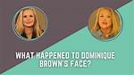 Dominique Brown: What Happened to Her Face?