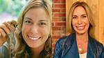 Dr. Mireya Mayor Lips Surgery: Transforming Smiles with Expertise