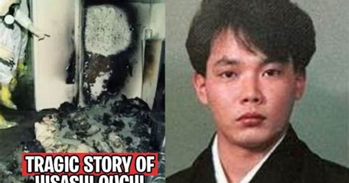 Hisashi Ouchi: the Tragic Story of a Radiation Accident Victim