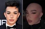 James Charles Bald: the Transformation of a Beauty Icon