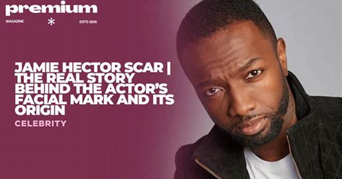 Jamie Hector Scar: the Untold Story Behind the Iconic Mark