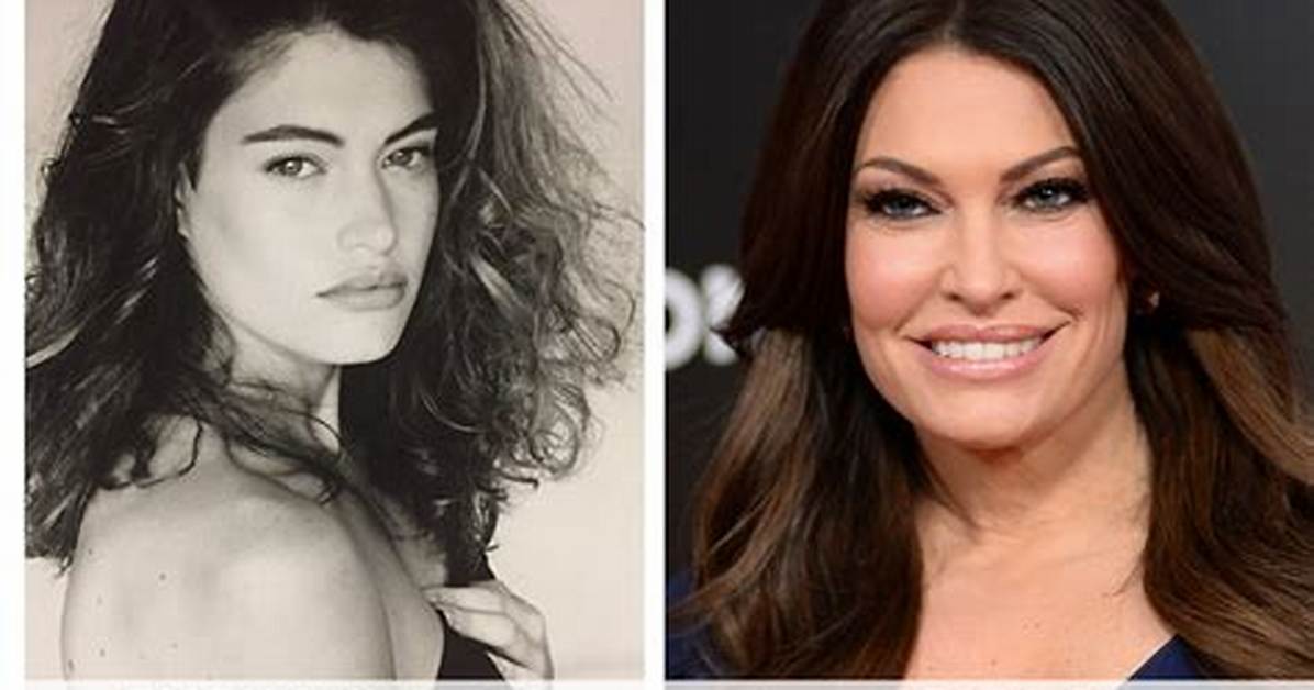 Kimberly Guilfoyle Before and After: a Comprehensive Look at Her Transformation