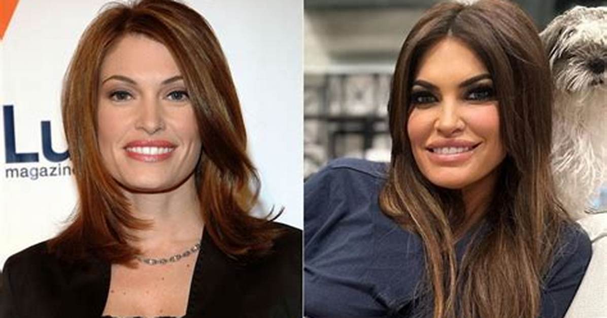 Kimberly Guilfoyle Face Lift: a Deep Dive into Her Transformation