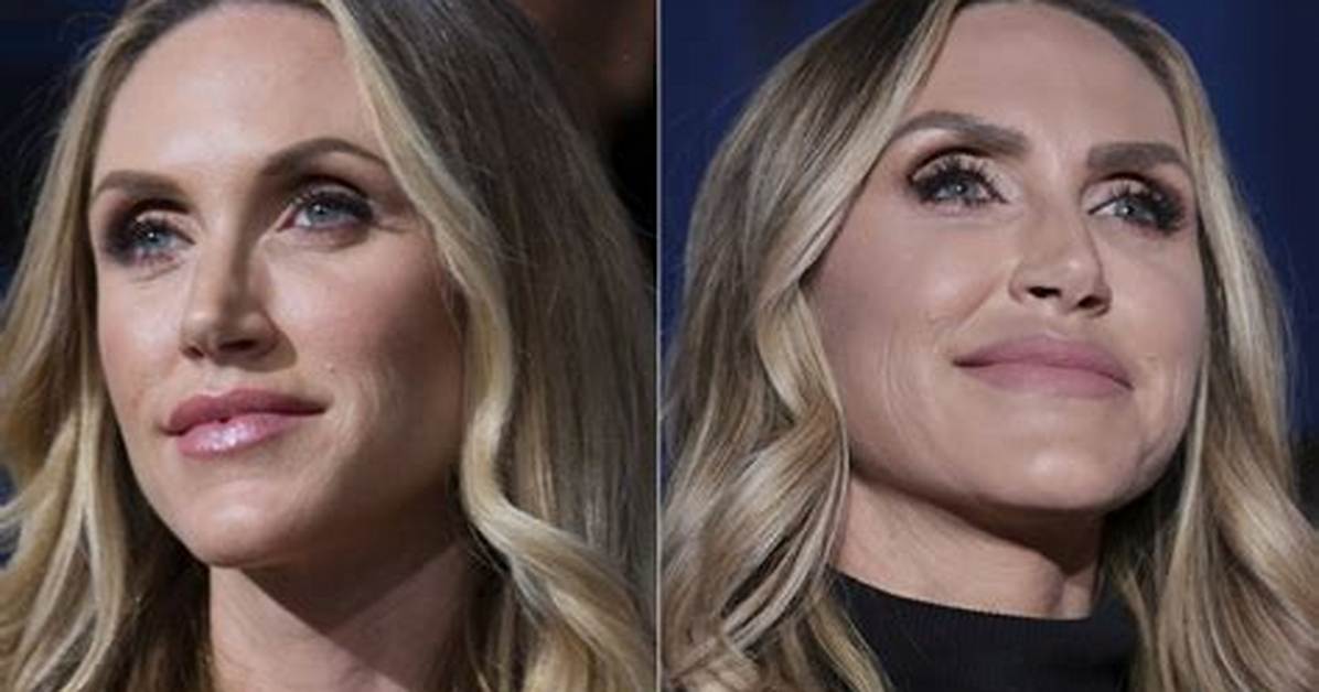 Lara Trump Plastic Surgery Before and After Transformation: the Full Story You Need to Know