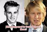 Owen Wilson's Nose: the Story Behind His Distinctive Feature