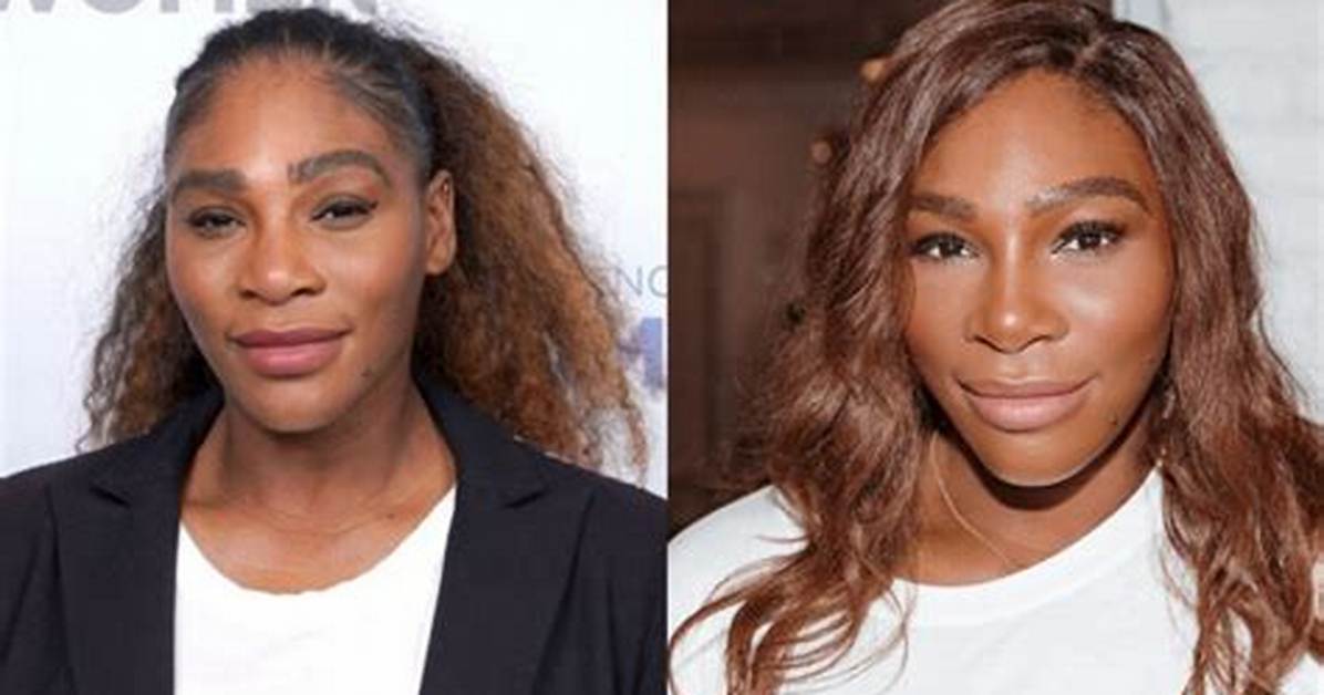 Serena Williams Surgery: a Comprehensive Insight into Her Journey and Recovery