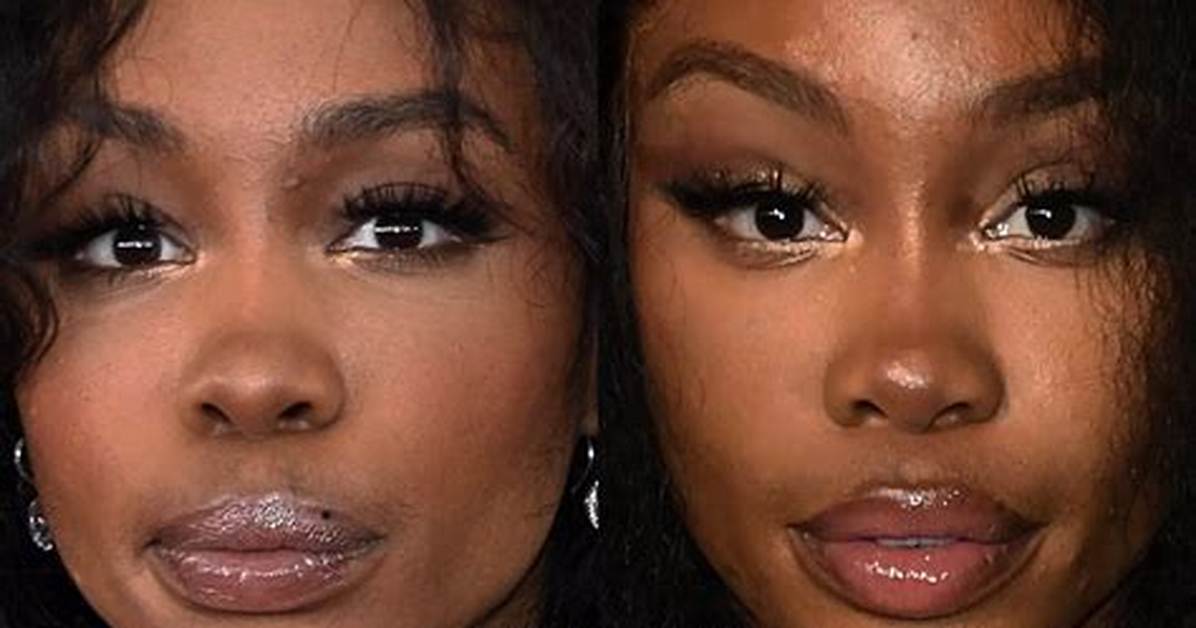 Sza Nose Job 2025: the Ultimate Guide to Her Transformation