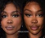 Sza Nose Job 2025: the Ultimate Guide to Her Transformation