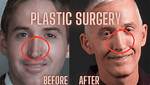 Trey Gowdy Nose Surgery: Understanding the Impact and Changes