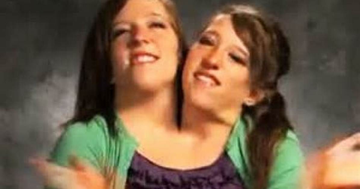 Understanding the Life and Journey of Conjoined Twin Abby Hensel