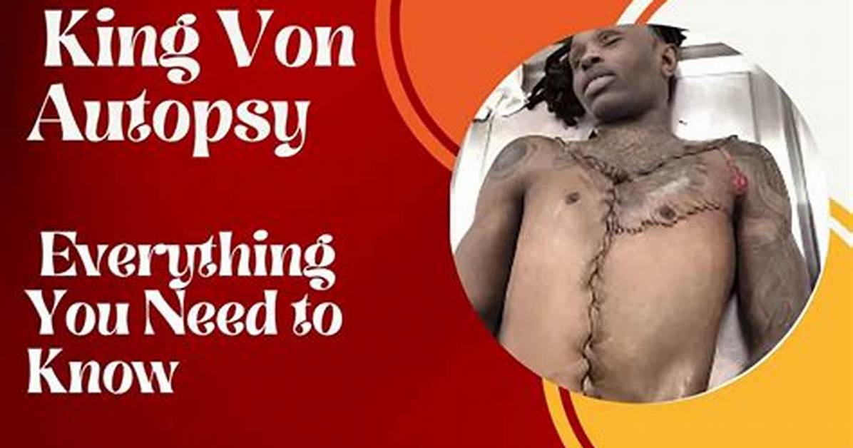 Unveiling the Mystery: King Von Autopsy Pic and Its Impact